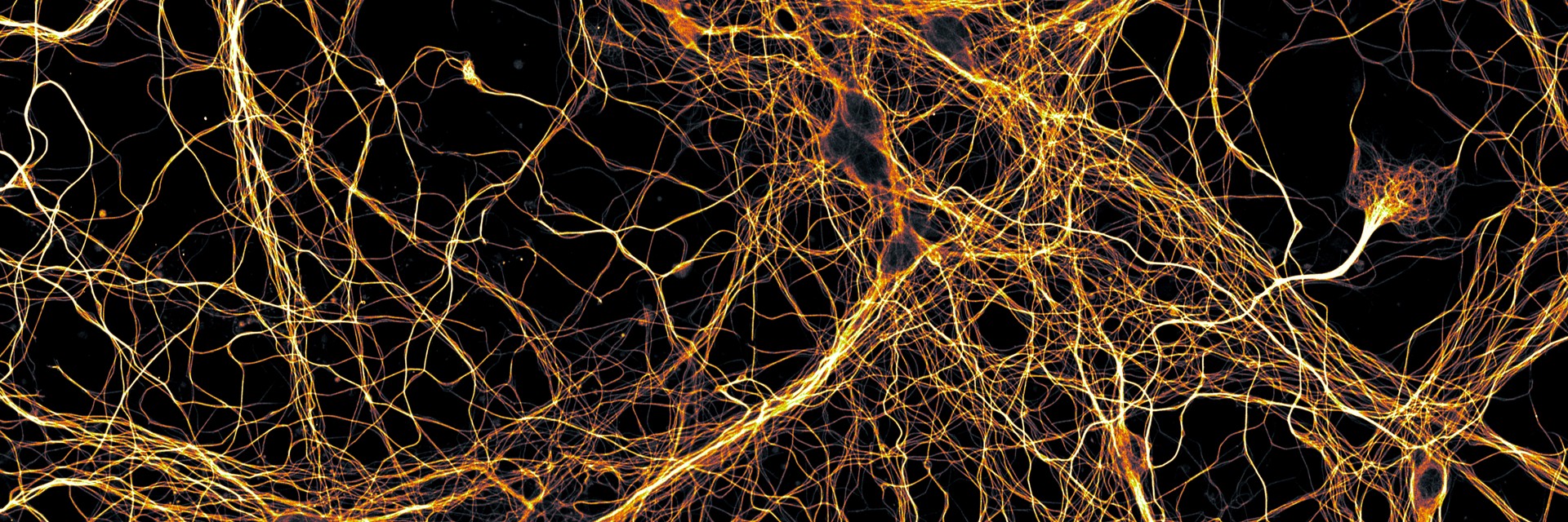Rede densa de axónios de neurónios de hipocampo em cultura, em tons de laranja sobre fundo escuro, com o corpo celular de um neurónio visível à direita