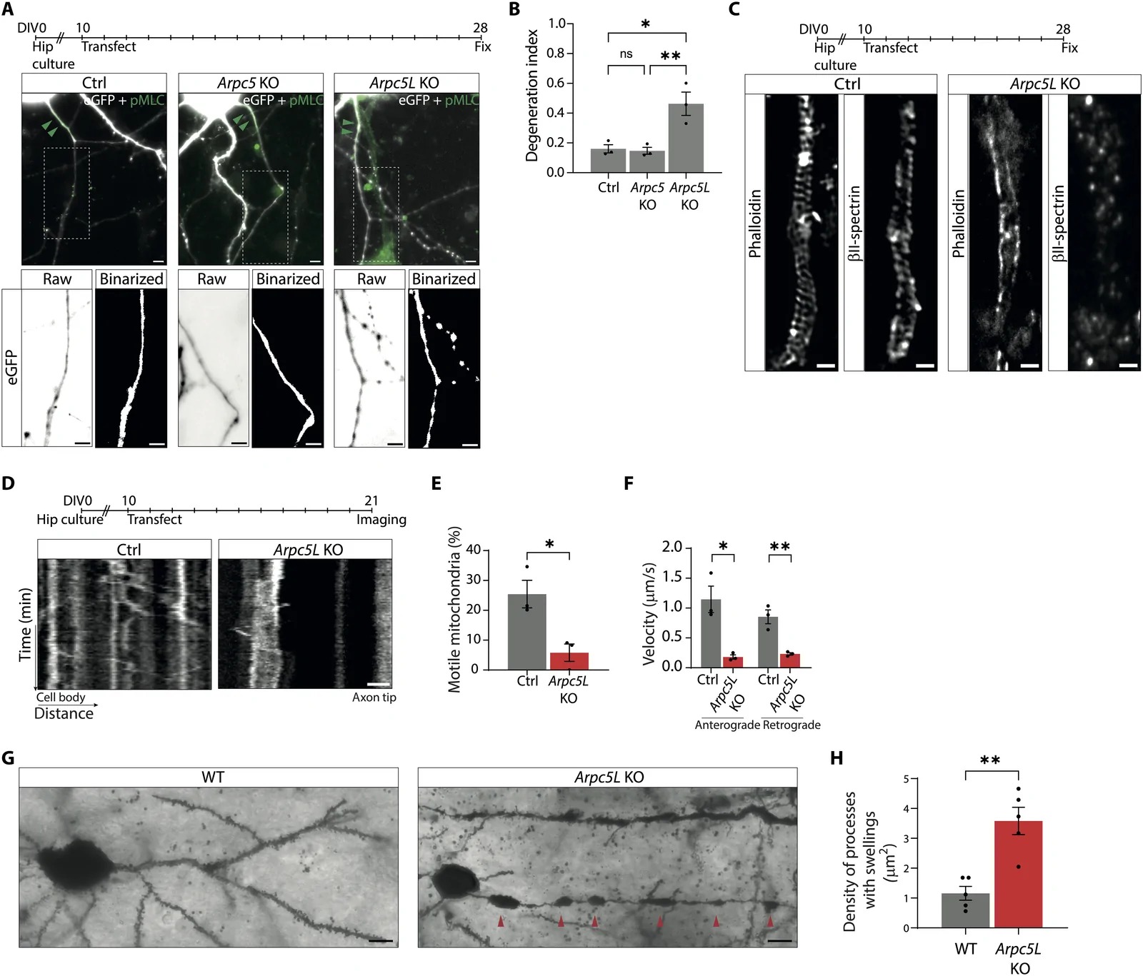 Figura científica com imagens de microscopia e gráficos: comparação entre um axónio de controlo e um axónio sem ARPC5L, com perda da organização periódica da actina e da espectrina, e gráficos de degeneração axonal e de transporte de mitocôndrias