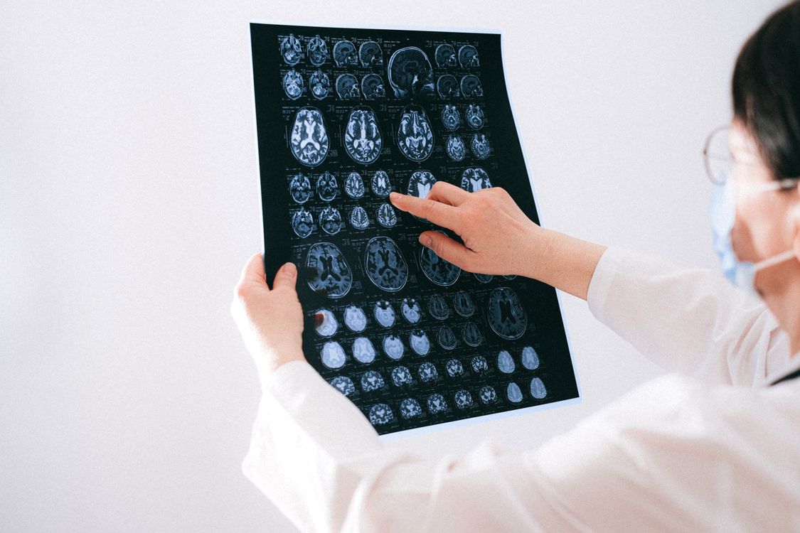 Conceito artístico de reparação neuronal: scaffold de micropartículas injetáveis (MAPS) que recruta células imunitárias para reconstruir tecido cerebral perdido após AVC