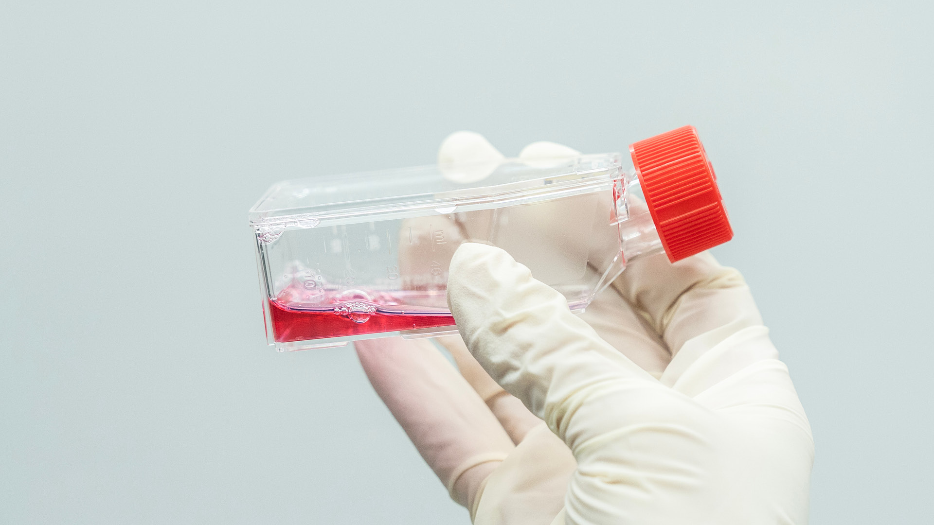 Mãos com luvas a segurar uma cultura de células em laboratório — o ambiente onde o anticorpo L2A5 foi desenvolvido e testado