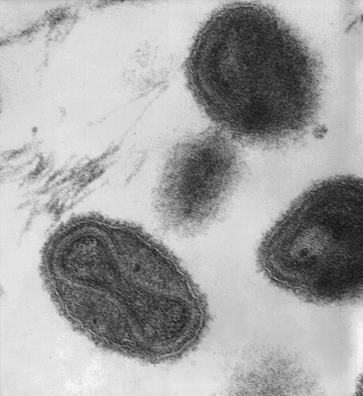 Microscopia eletrónica de transmissão do vírus da varíola (virions em forma de tijolo)
